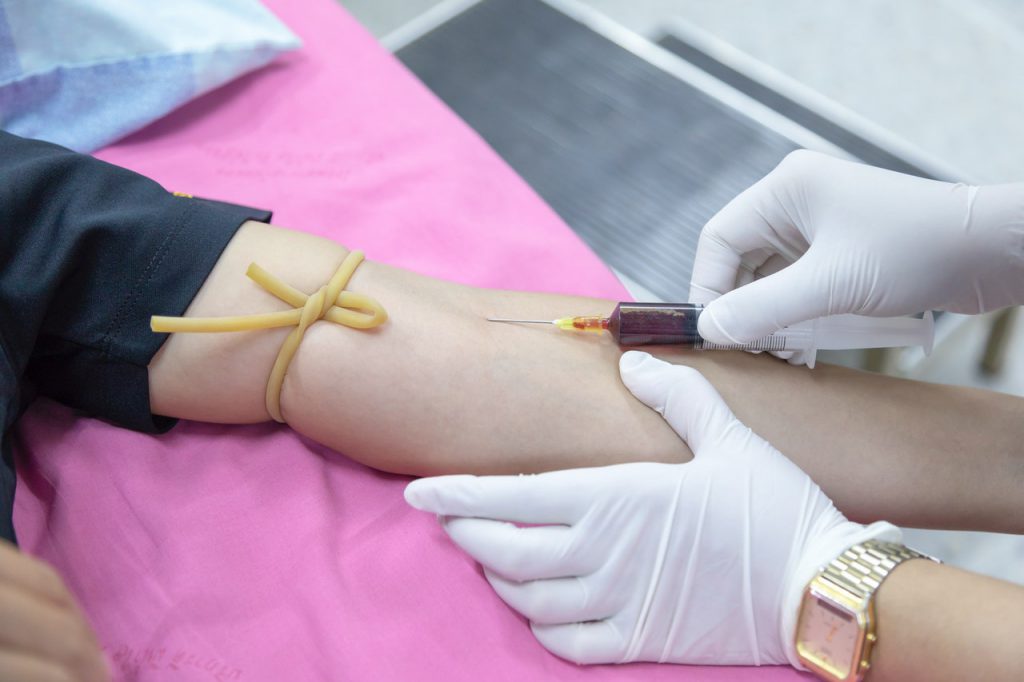 Raktamokshan blood-letting therapy setup